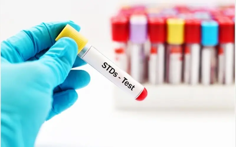 xét nghiệm STDs