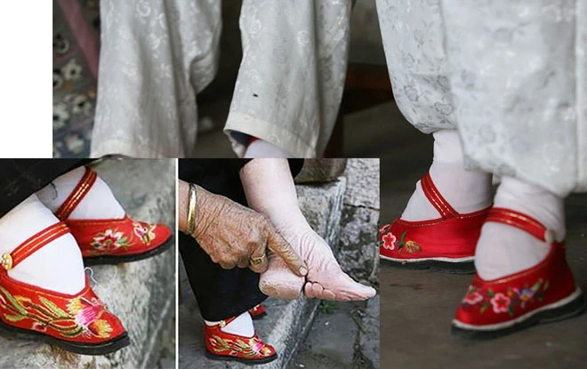 tục bó chân china lotus feet